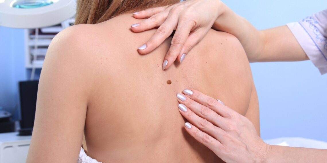 Medicinski centar Gorica otvorio je niz specijalističkih ambulanti, a najnovija je dermatologija