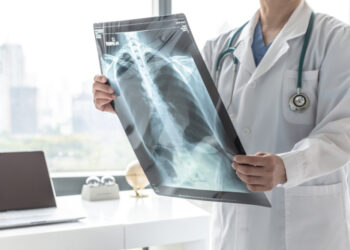 Od ove kronične bolesti pluća obolijevaju mnogi: Evo kako je prepoznati