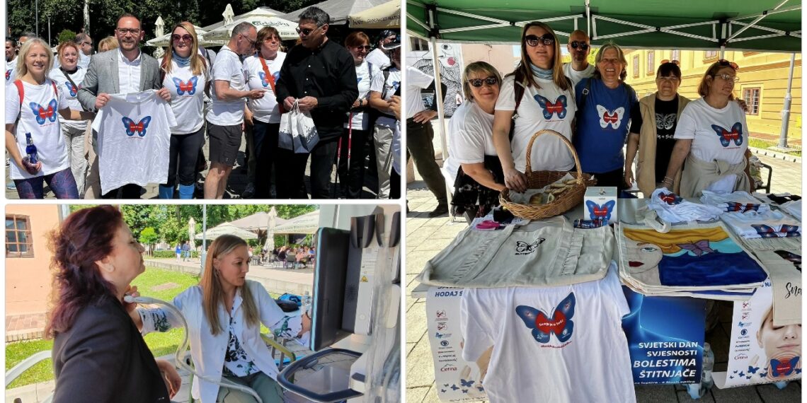 ultrazvučni pregled